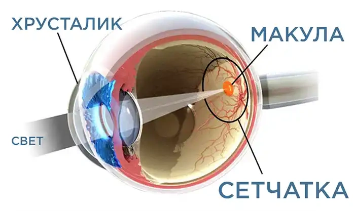 Макулярная дегенерация: иллюстрация к статье