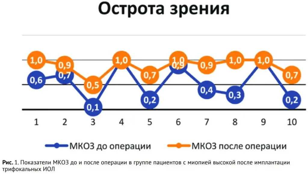 Рис. 1. Показатели МКОЗ до и после операции в группе пациентов с миопией высокой после имплантации трифокальных ИОЛ